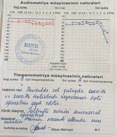 "KİND SƏS" eşitmə mərkəzində fırıldaq 